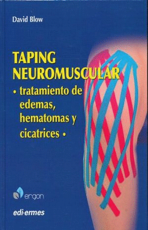 TAPING NEUROMUSCULAR: TRATAMIENTO DE EDEMAS, HEMATOMAS Y CICATRICES